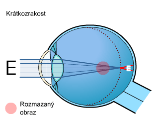 kompenzace spojkou