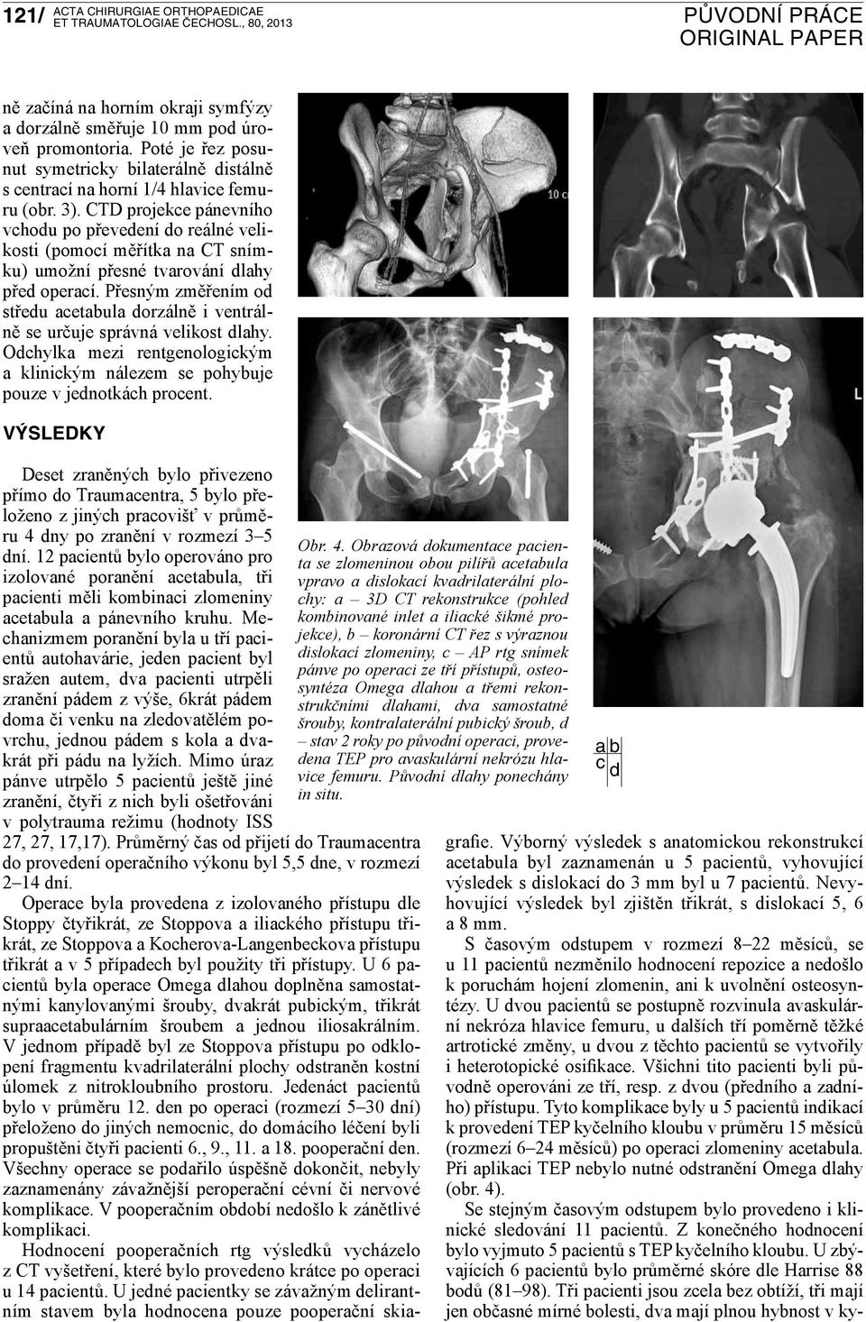 Přesným změřením od středu acetabula dorzálně i ventrálně se určuje správná velikost dlahy. Odchylka mezi rentgenologickým a klinickým nálezem se pohybuje pouze v jednotkách procent.
