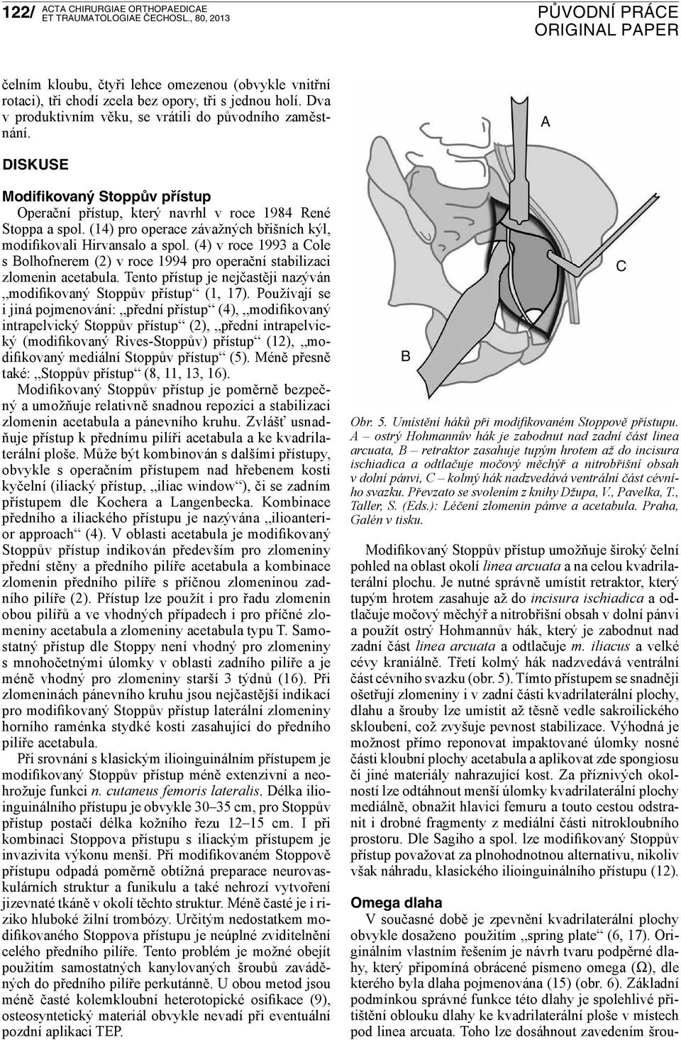 (4) v roce 1993 a Cole s Bolhofnerem (2) v roce 1994 pro operační stabilizaci zlomenin acetabula. Tento přístup je nejčastěji nazýván modifikovaný Stoppův přístup (1, 17).