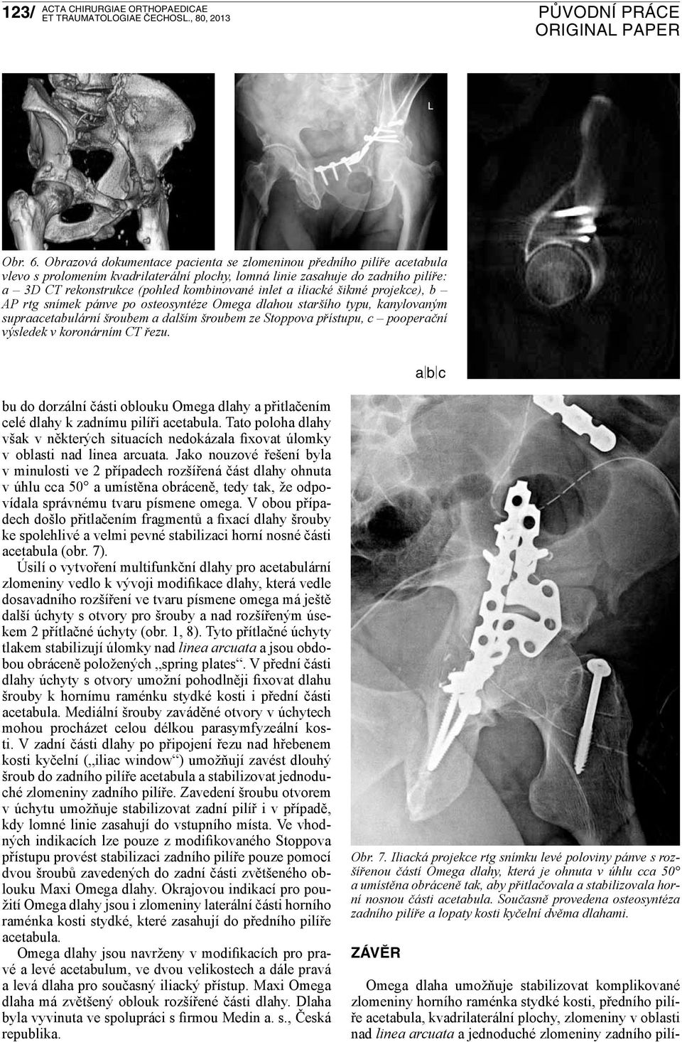a iliacké šikmé projekce), b AP rtg snímek pánve po osteosyntéze Omega dlahou staršího typu, kanylovaným supraacetabulární šroubem a dalším šroubem ze Stoppova přístupu, c pooperační výsledek v