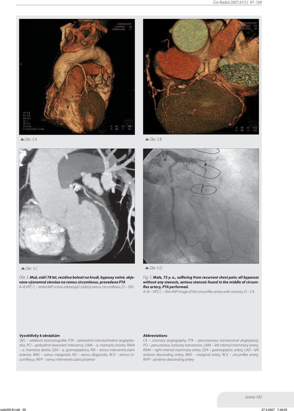 Muž, stáří 78 let, recidiva bolestí na hrudi, bypassy volné, objevena významná stenóza na ramus circumlexus, provedena PTA A B VRT; C tenká MIP vrstva zobrazující zúžený ramus circumflexus, D SKG D