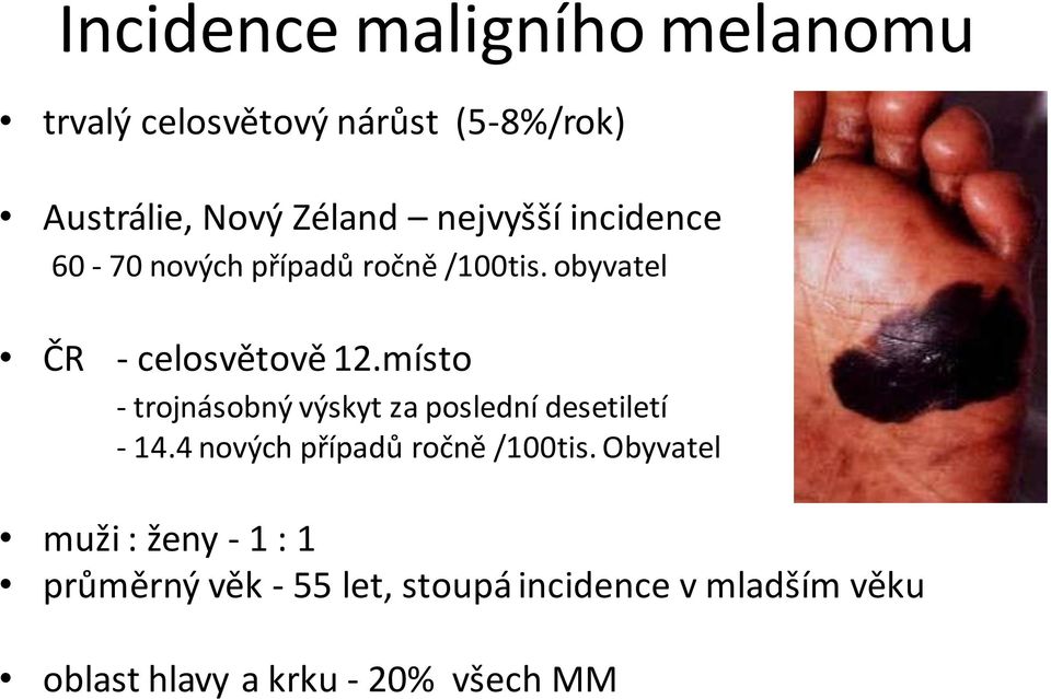 místo - trojnásobný výskyt za poslední desetiletí - 14.4 nových případů ročně /100tis.