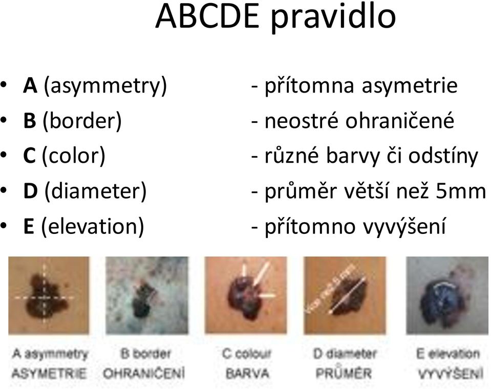 asymetrie - neostré ohraničené - různé barvy