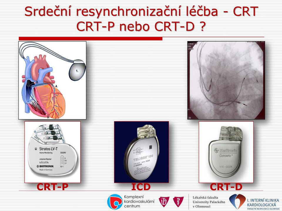 léčba - CRT CRT-P