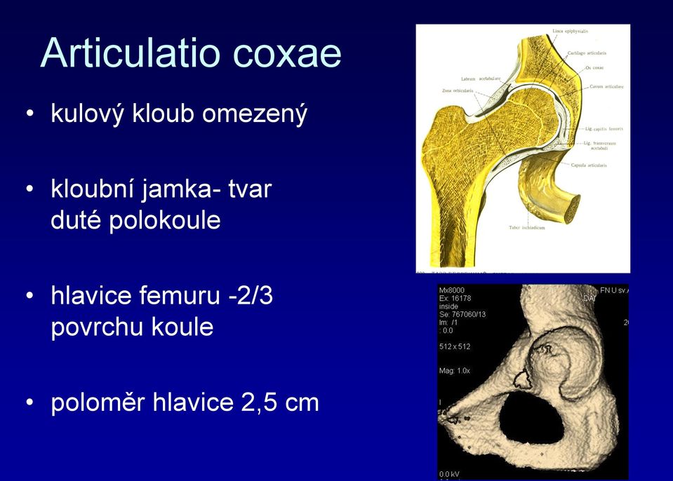 polokoule hlavice femuru -2/3