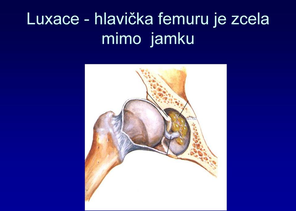 femuru je