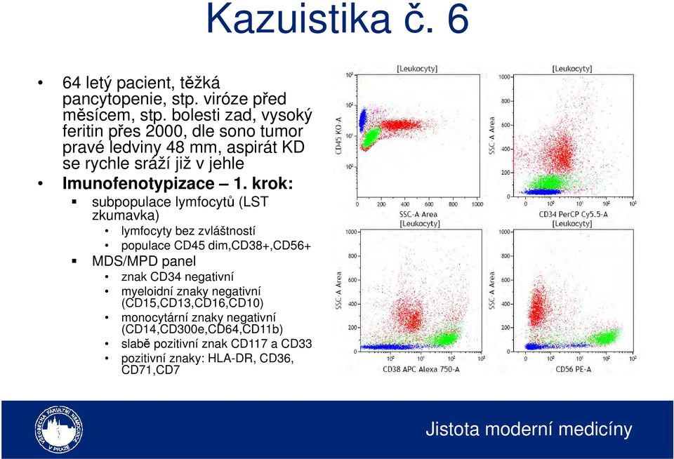 1. krok: subpopulace lymfocytů (LST zkumavka) lymfocyty bez zvláštností populace CD45 dim,cd38+,cd56+ MDS/MPD panel znak CD34