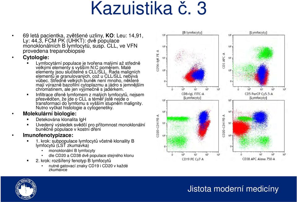 Řada maligních elementů je granulovaných, což u CLL/SLL nebývá vůbec.