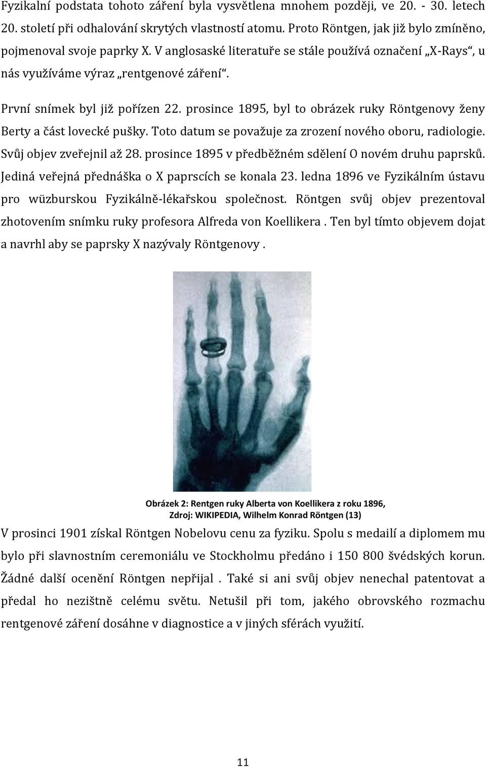 prosince 1895, byl to obrázek ruky Röntgenovy ženy Berty a část lovecké pušky. Toto datum se považuje za zrození nového oboru, radiologie. Svůj objev zveřejnil až 28.