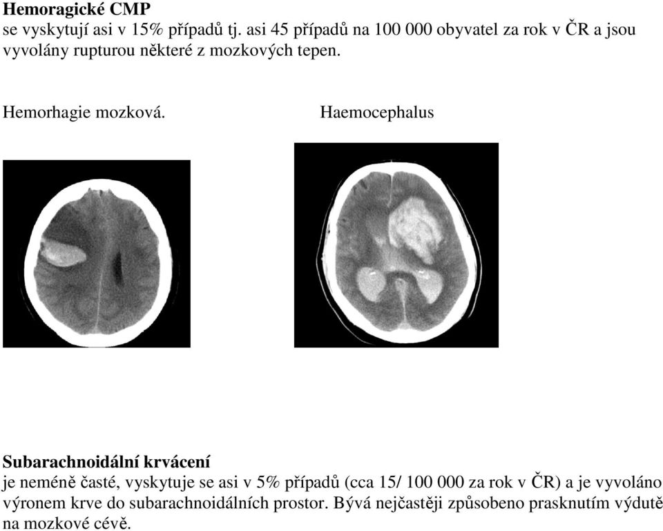 Hemorhagie mozková.