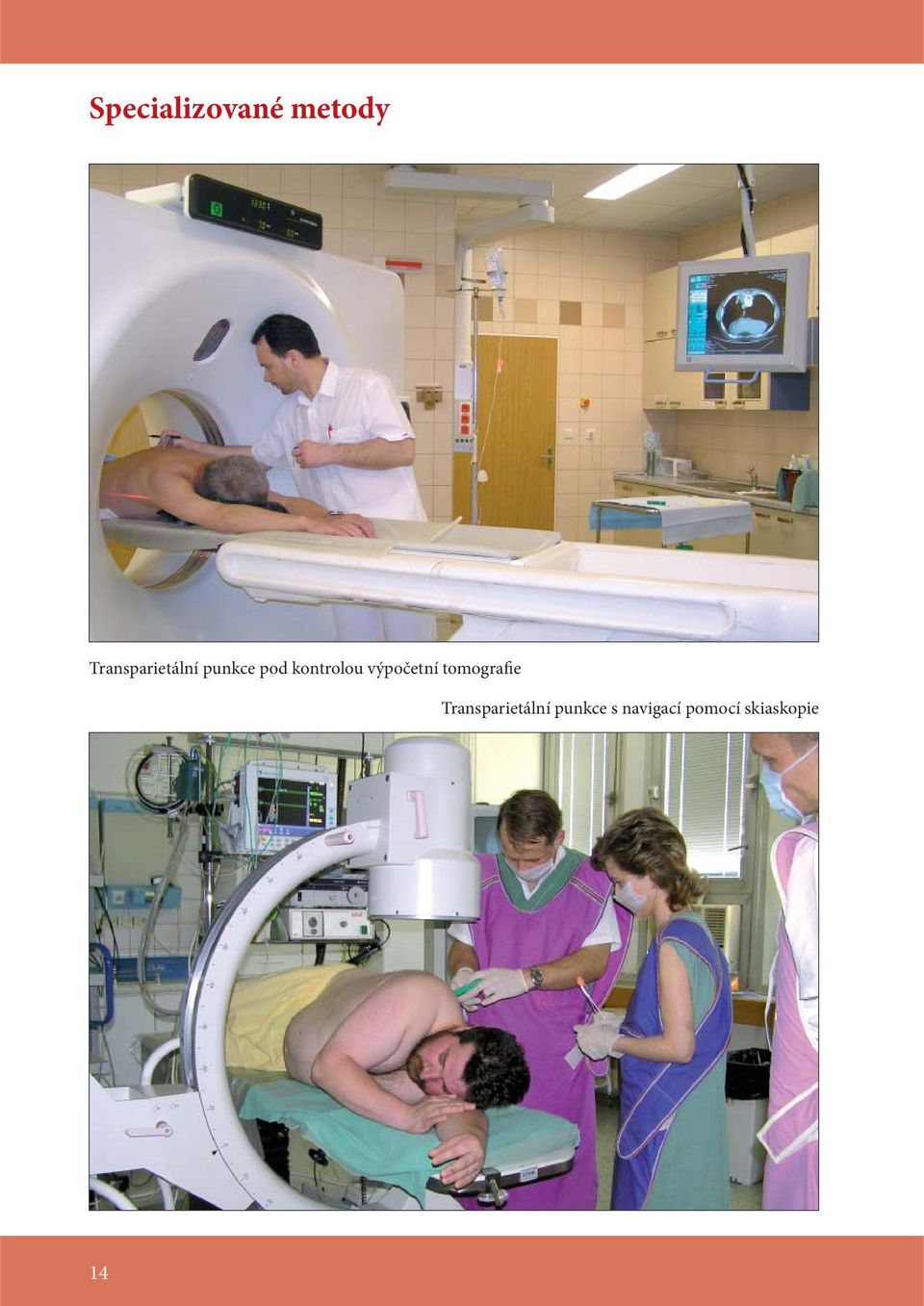 kontrolou výpočetní tomografie