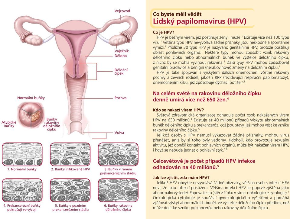 1 Některé typy mohou způsobit vznik rakoviny děložního čípku nebo abnormálních buněk ve výstelce děložního čípku, z nichž by se mohla vyvinout rakovina.