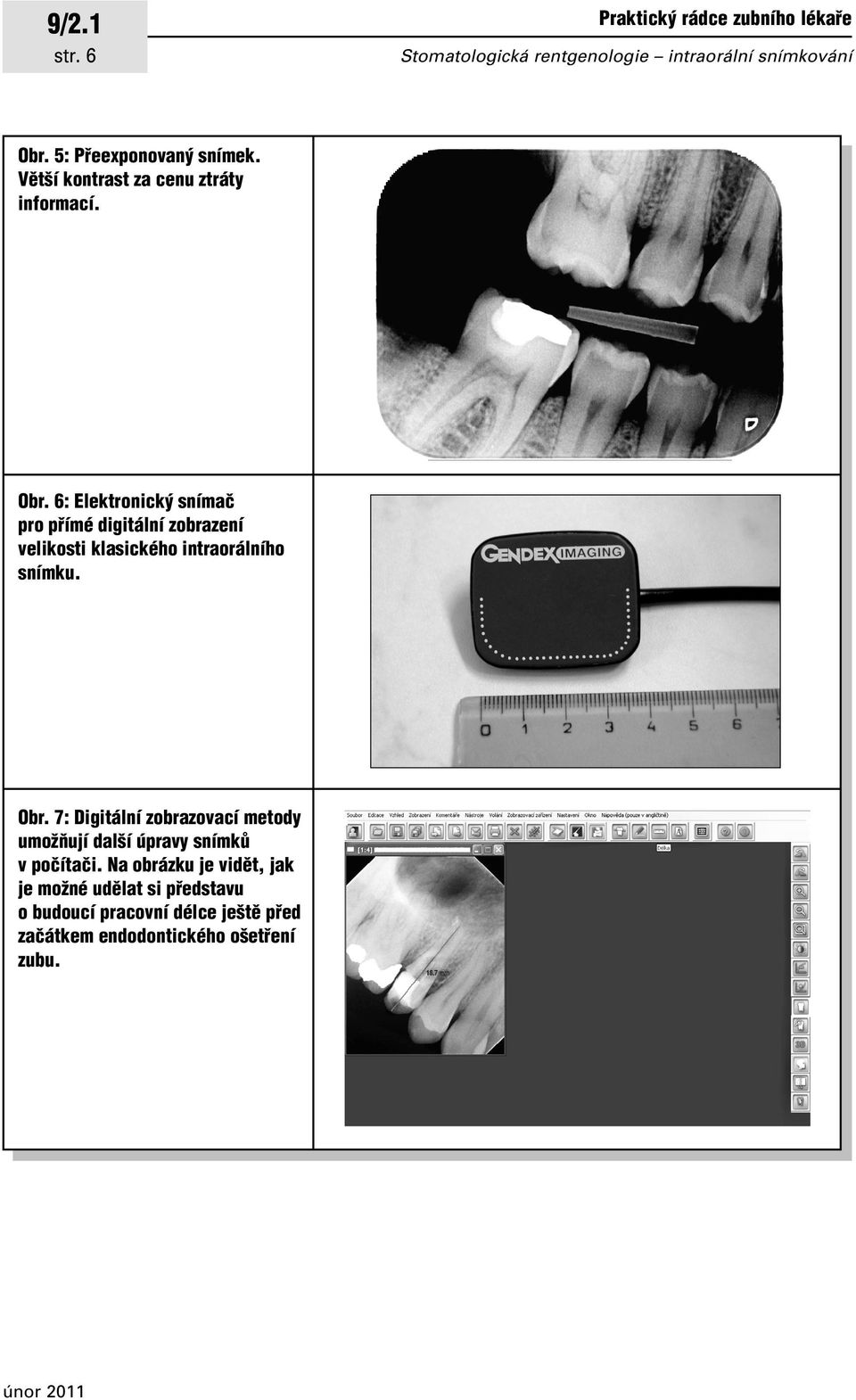 6: Elektronick snímaã pro pfiímé digitální zobrazení velikosti klasického intraorálního snímku. Obr.