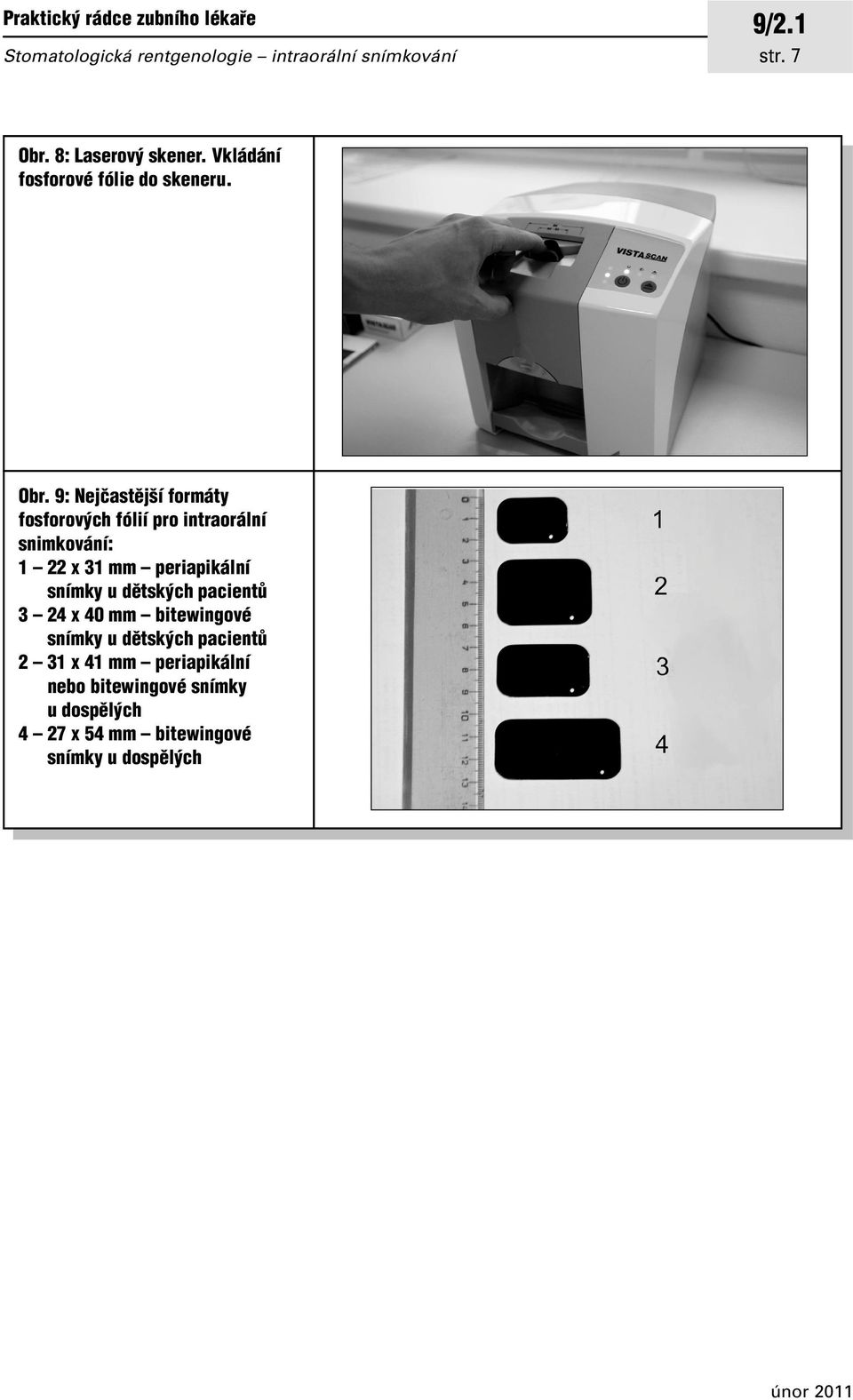 9: Nejãastûj í formáty fosforov ch fólií pro intraorální snimkování: 1 22 x 31 mm periapikální