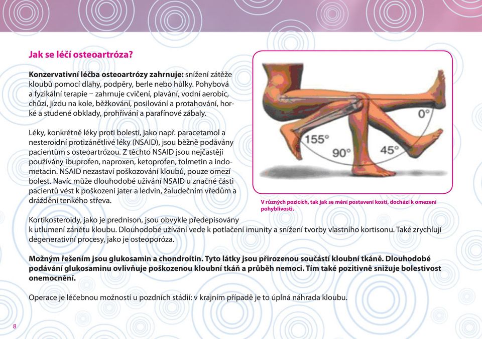 Léky, konkrétně léky proti bolesti, jako např. paracetamol a nesteroidní protizánětlivé léky (NSAID), jsou běžně podávány pacientům s osteoartrózou.