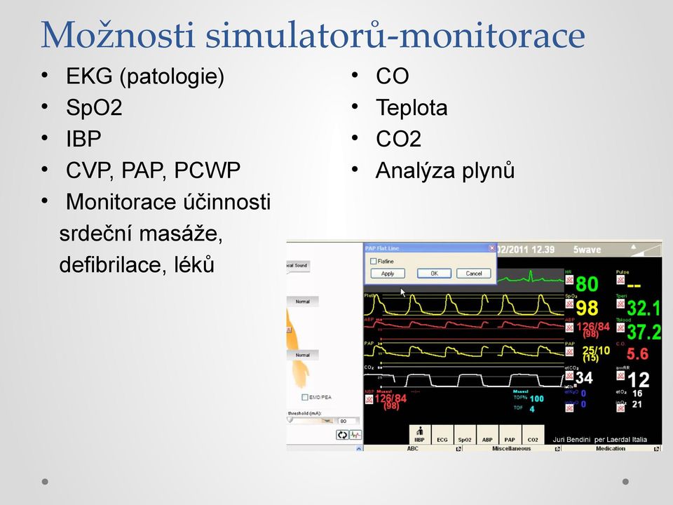 Monitorace účinnosti srdeční masáže,