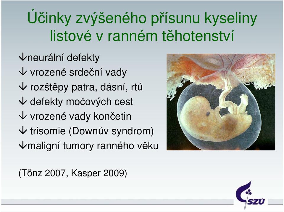 rtů defekty močových cest vrozené vady končetin trisomie