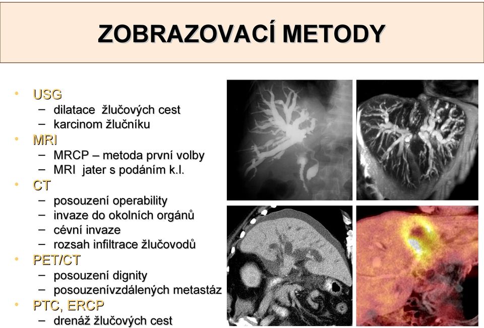 y MRI jater s podáním k.l.