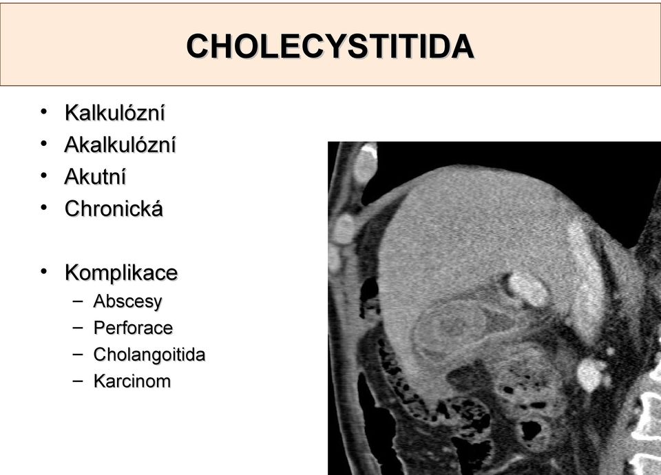Chronická Komplikace