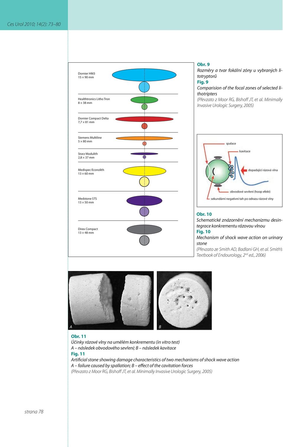 Minimally Invasive Urologic Surgery, 2005) Dornier Compact Delta 7,7 81 mm Siemens Multiline 5 80 mm spalace Storz Modulith 2,8 37 mm kavitace Medispec Econolith 13 60 mm dopadající rázová vlna