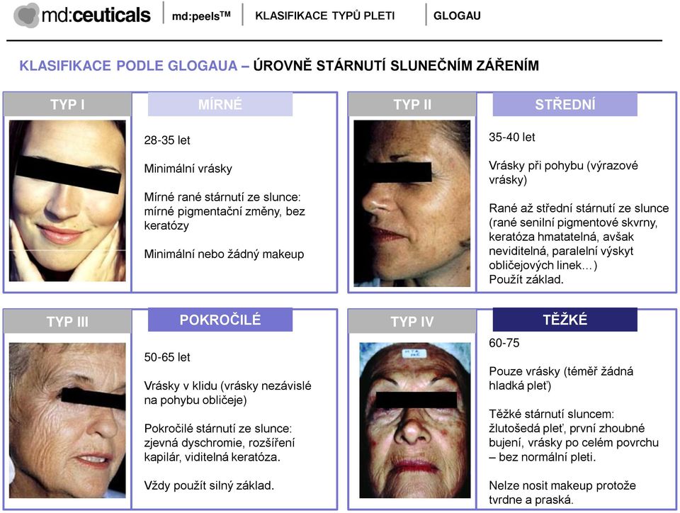 neviditelná, paralelní výskyt obličejových linek ) Pouţít základ.