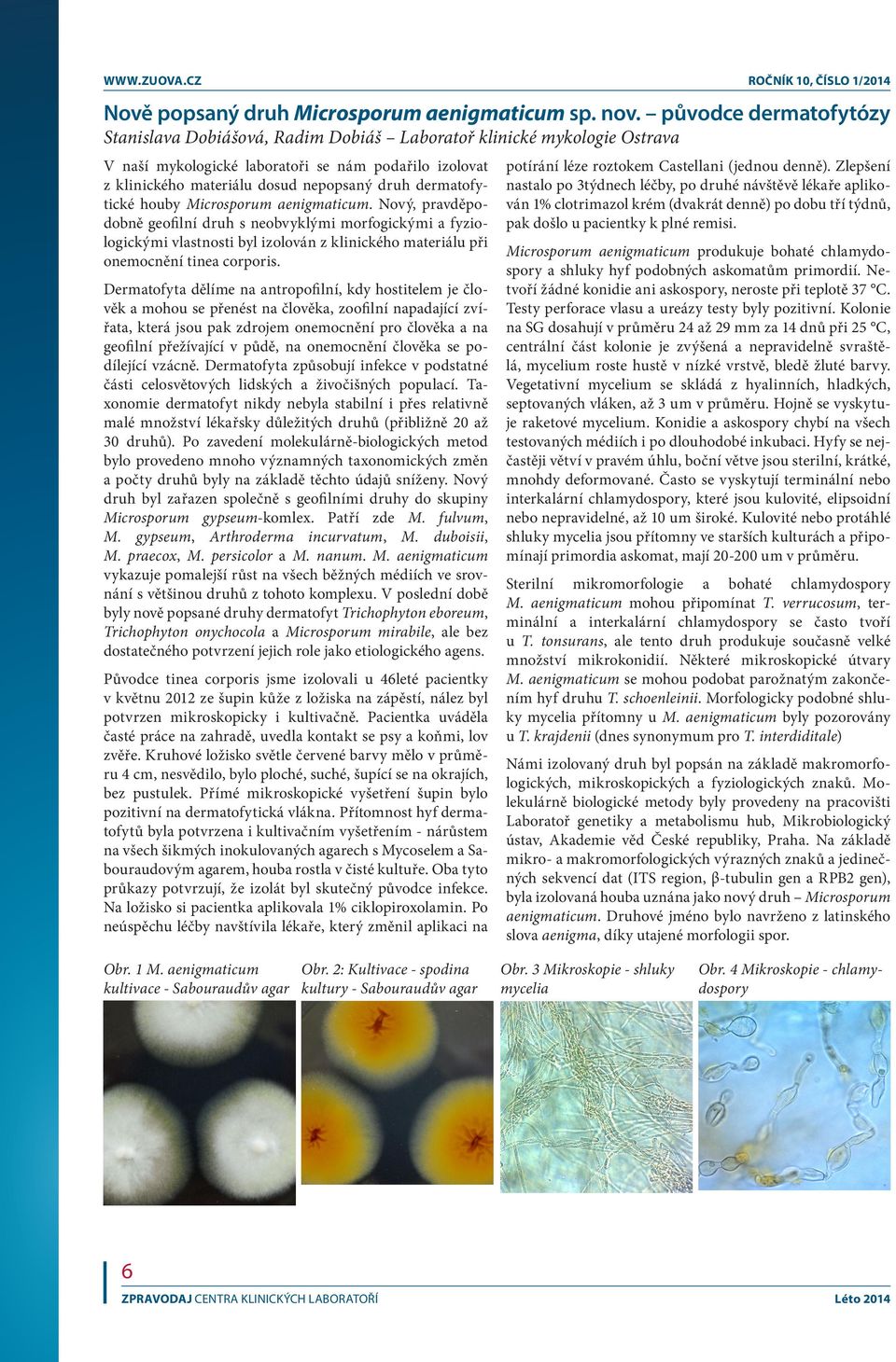 dermatofytické houby Microsporum aenigmaticum.
