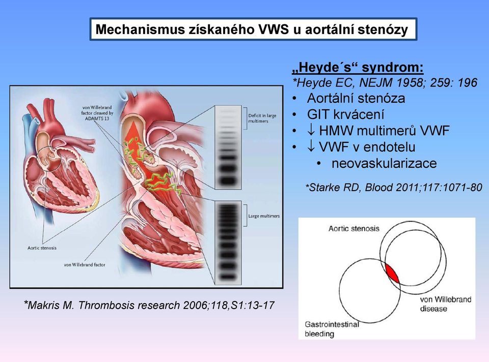 HMW multimerů VWF VWF v endotelu neovaskularizace *Starke RD,