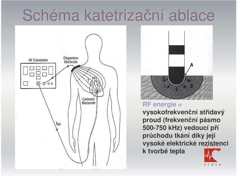 pásmo 500-750 khz) vedoucí pí prchodu tkání