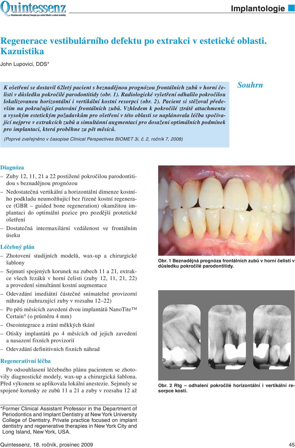 Radiologické vyšetření odhalilo pokročilou lokalizovanou horizontální i vertikální kostní resorpci (obr. 2). Pacient si stěžoval především na pokračující putování frontálních zubů.