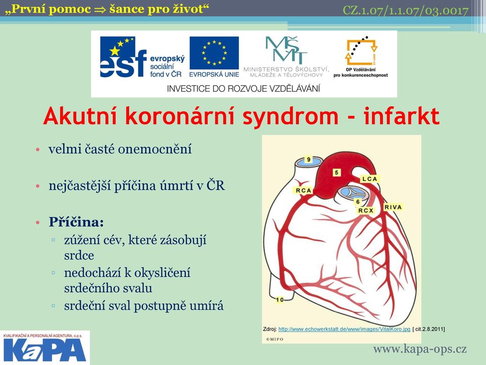 srdce nedochází k okysličení srdečního svalu srdeční sval postupně