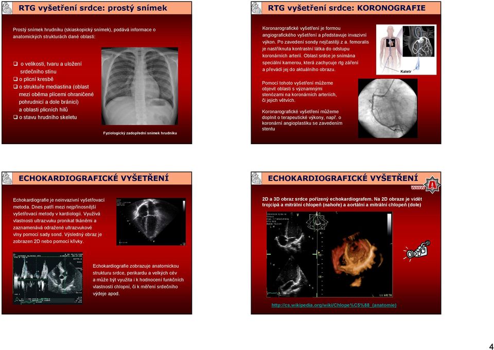 a oblasti plicních hilů o stavu hrudního skeletu Fyziologický zadopřední snímek hrudníku Koronarografické vyšetření je formou angiografického vyšetření a představuje invazivní výkon.