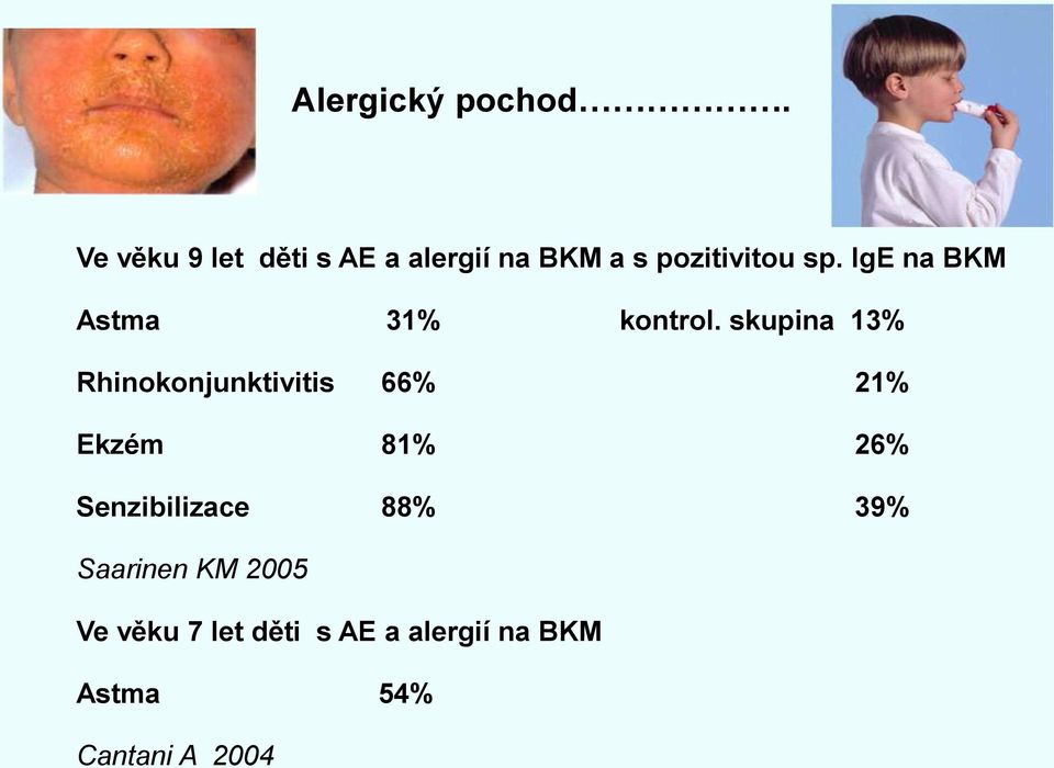 IgE na BKM Astma 31% kontrol.