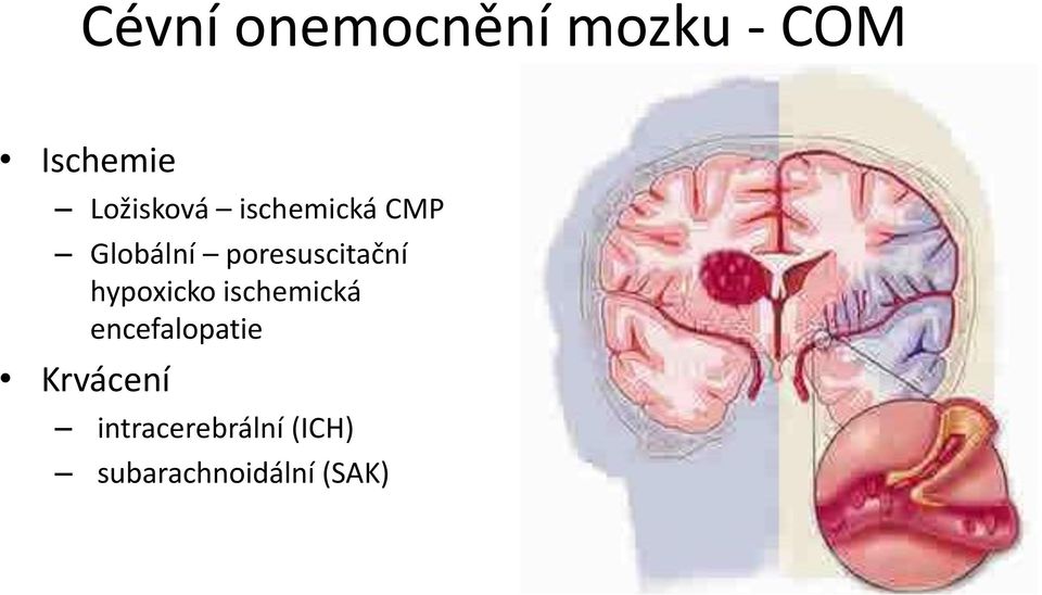 poresuscitační hypoxicko ischemická