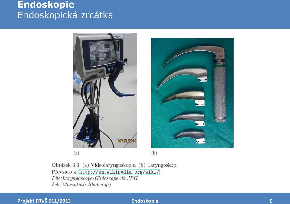 Endoskopie. Biofyzikální ústav LF MU. Projekt FRVŠ 911/ PDF Stažení zdarma