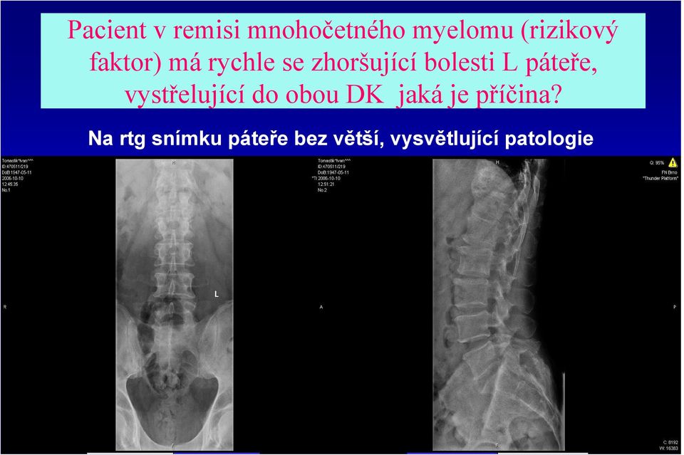 páteře, vystřelující do obou DK jaká je příčina?