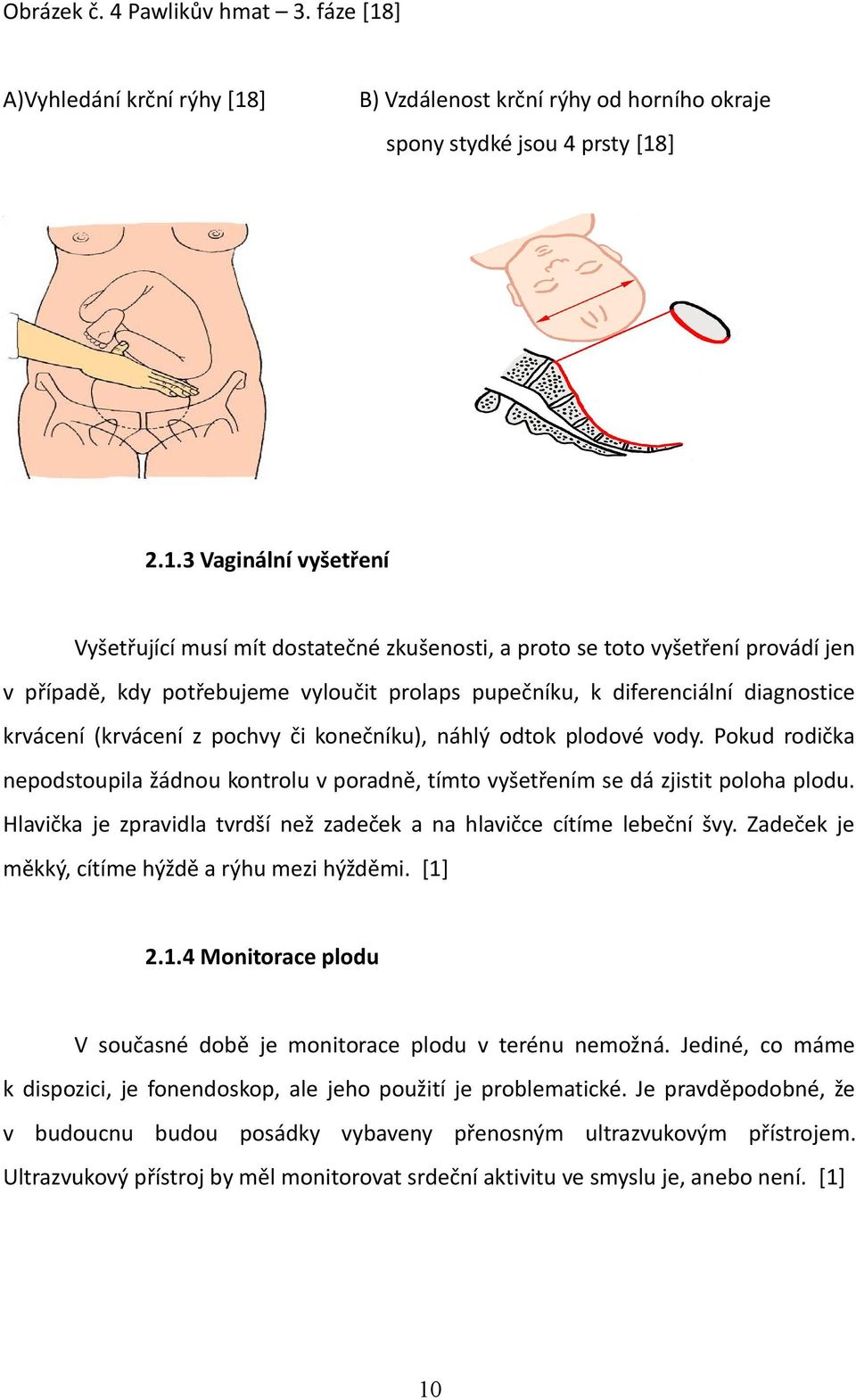 ] B) Vzdálenost krční rýhy od horního okraje spony stydké jsou 4 prsty [18