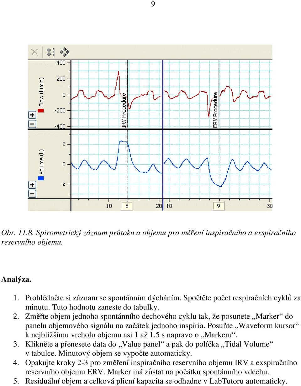 Změřte objem jednoho spontánního dechového cyklu tak, že posunete Marker do panelu objemového signálu na začátek jednoho inspíria. Posuňte Waveform kursor k nejbližšímu vrcholu objemu asi 1 až 1.