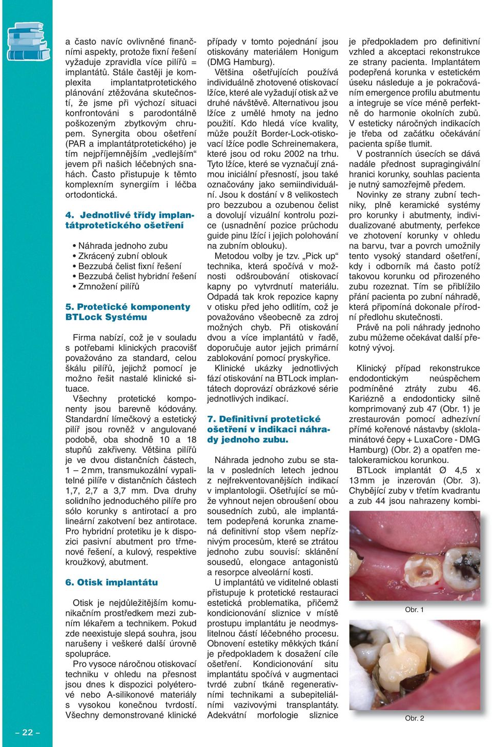 Synergita obou ošetření (PAR a implantátprotetického) je tím nejpříjemnějším vedlejším jevem při našich léčebných snahách. Často přistupuje k těmto komplexním synergiím i léčba ortodontická. 4.