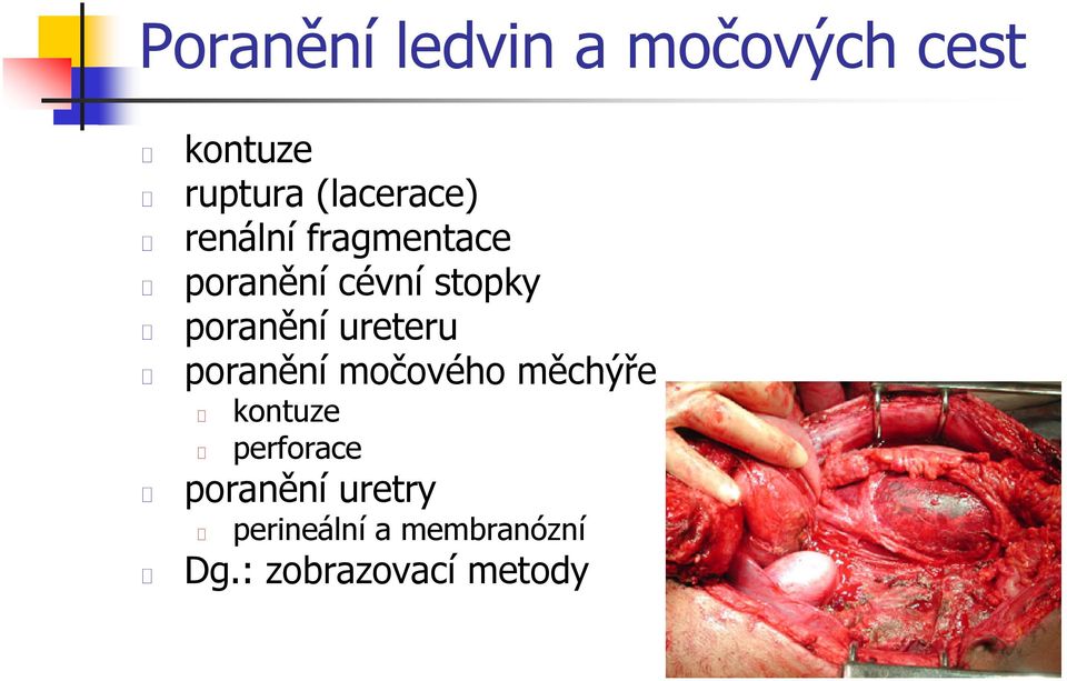 poranění ureteru poranění močového měchýře kontuze