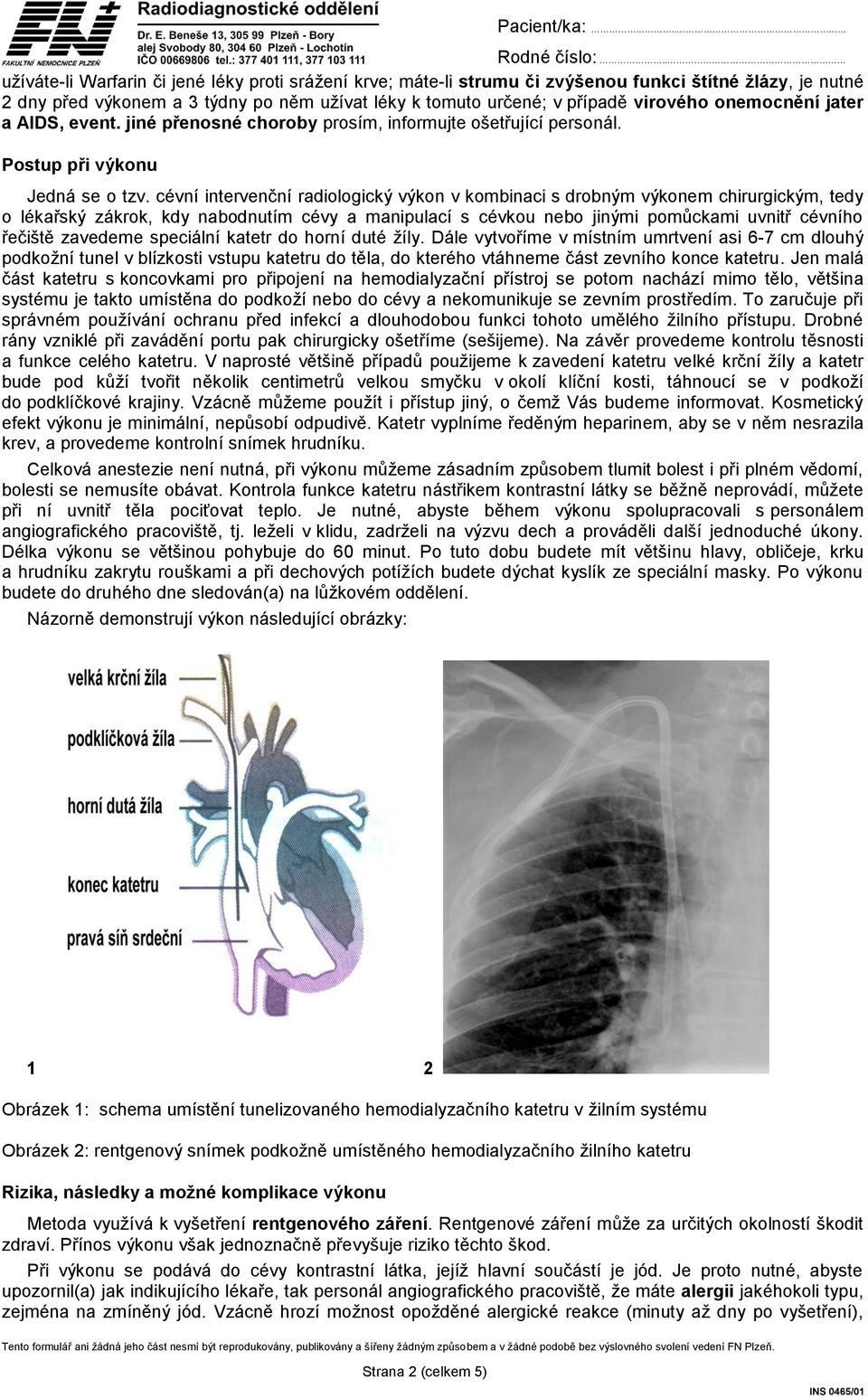 cévní intervenční radiologický výkon v kombinaci s drobným výkonem chirurgickým, tedy o lékařský zákrok, kdy nabodnutím cévy a manipulací s cévkou nebo jinými pomůckami uvnitř cévního řečiště