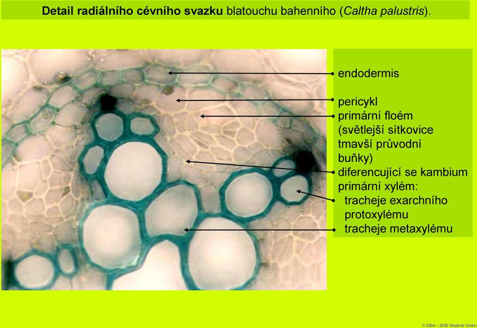 endodermis pericykl primární floém (světlejší sítkovice