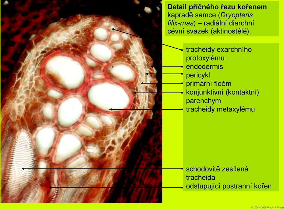 tracheidy exarchního protoxylému endodermis pericykl primární floém