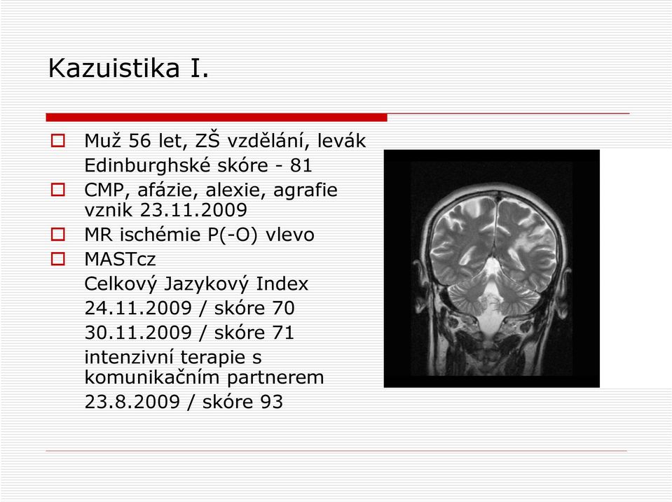 alexie, agrafie vznik 23.11.