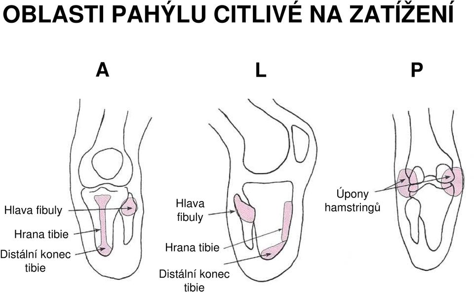 konec tibie Hlava fibuly Hrana tibie