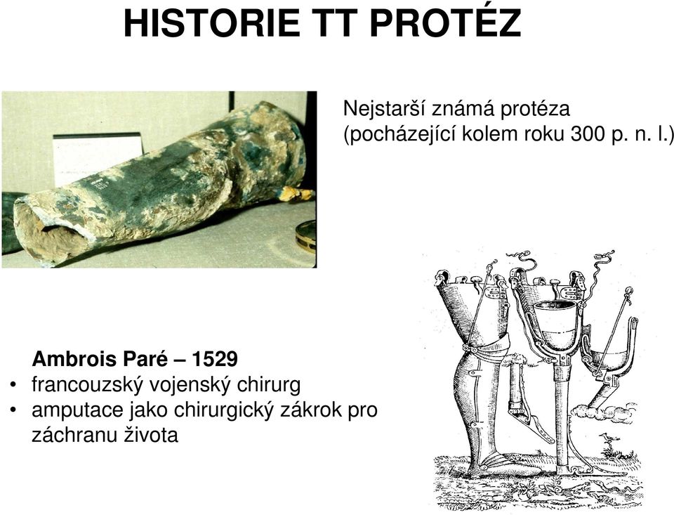 ) Ambrois Paré 1529 francouzský vojenský