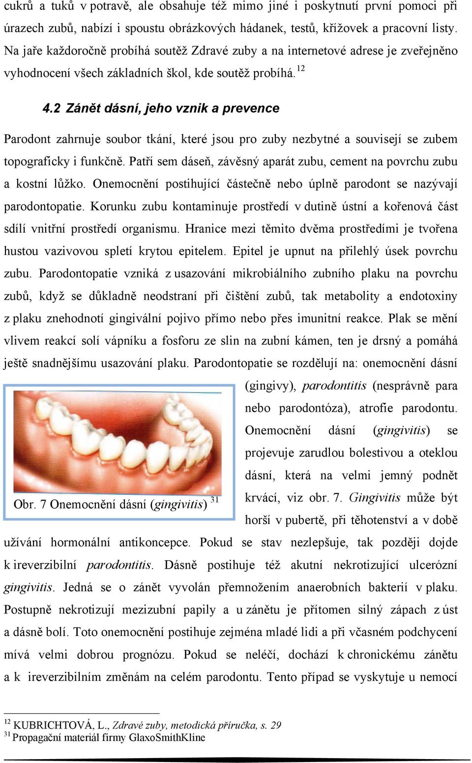 2 Zánět dásní, jeho vznik a prevence Parodont zahrnuje soubor tkání, které jsou pro zuby nezbytné a souvisejí se zubem topograficky i funkčně.