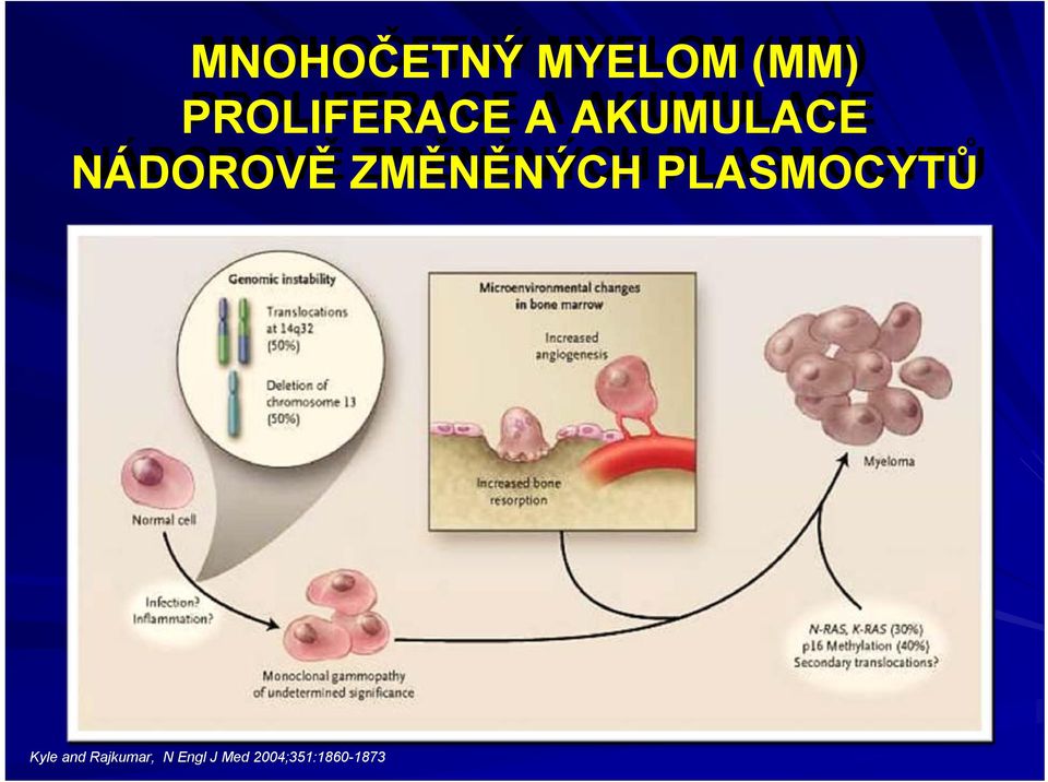 NÁDOROVĚ ZMĚNĚNÝCH PLASMOCYTŮ