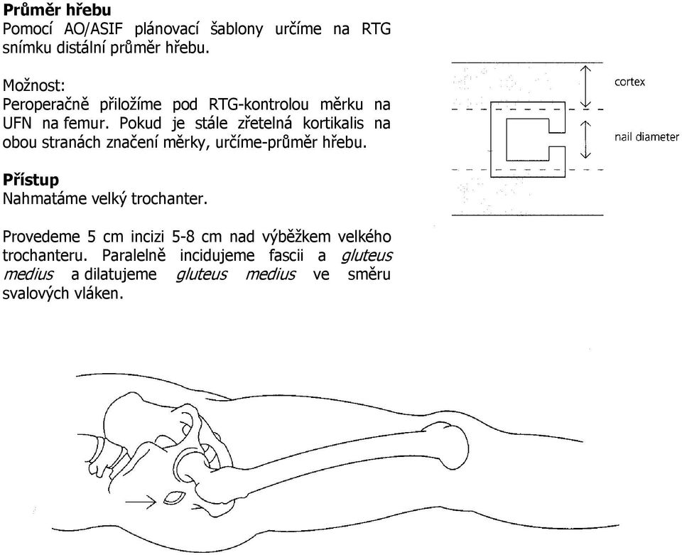 Pokud je stále zřetelná kortikalis na obou stranách značení měrky, určíme-průměr hřebu.