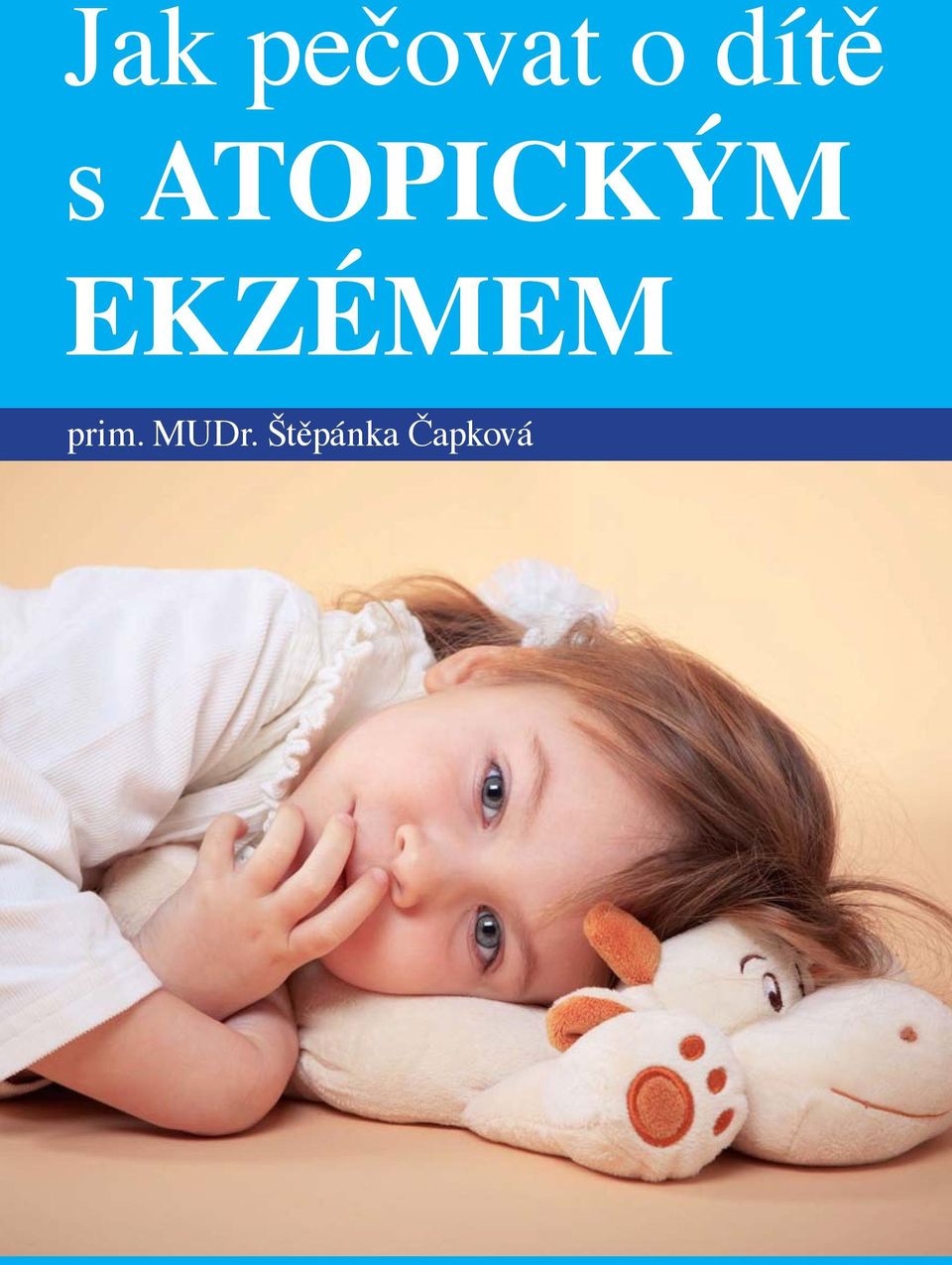 EKZÉMEM prim.