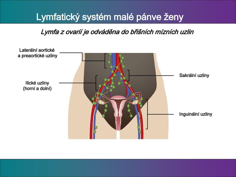 Laterální aortické a preaortické uzliny Ilické